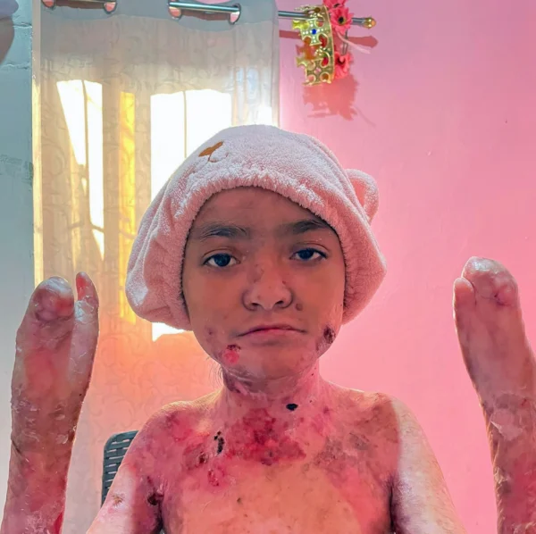 Donation For Pain Medicine
