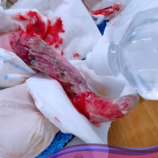 Donation For Pain Medicine - Image 7